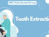 Tooth Extraction | Procedure, Aftercare & Recovery