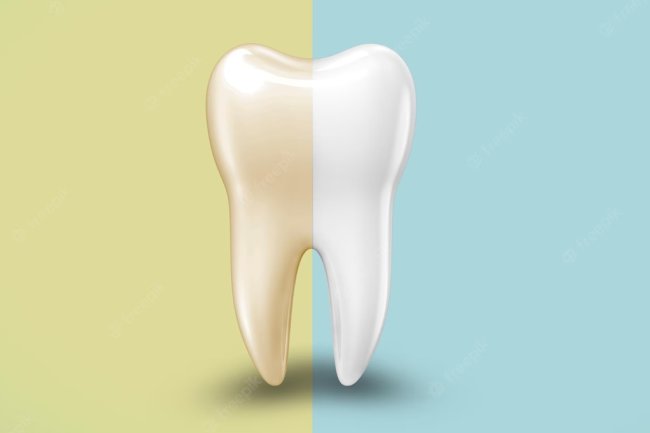 What Is Considered a Dental Emergency?