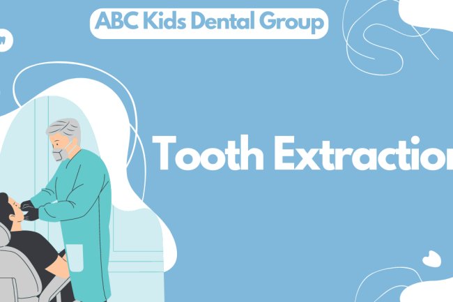 Tooth Extraction | Procedure, Aftercare & Recovery